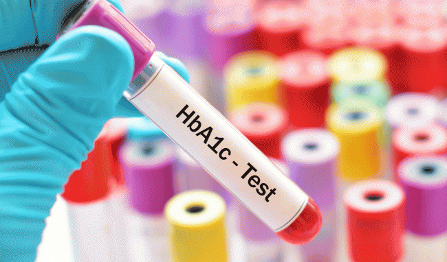 xét nghiệm HbA1c