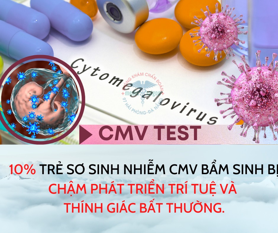 Xét nghiệm Virus Cytomegalo (CMV)